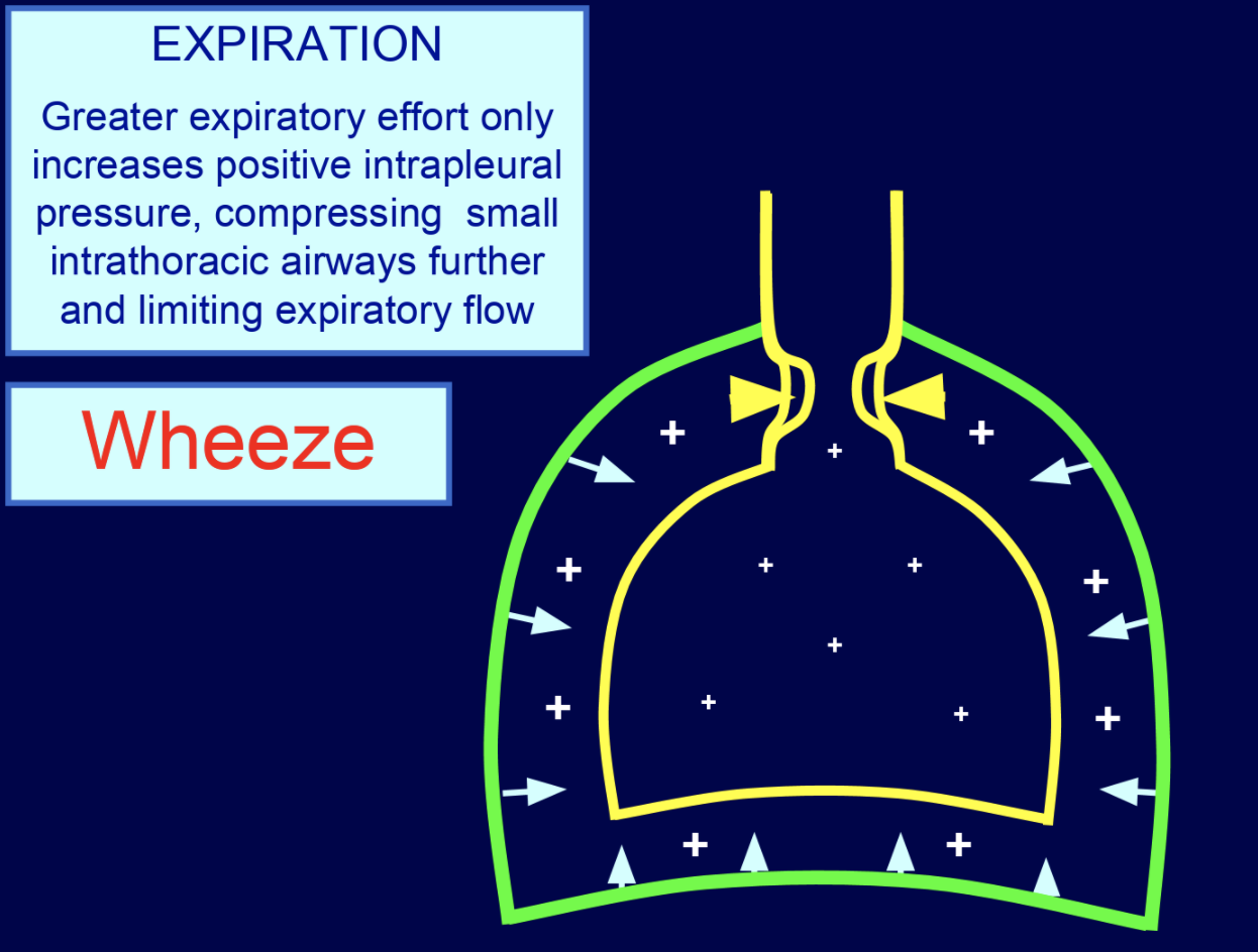 Wesp Inhalation Lecture Notes