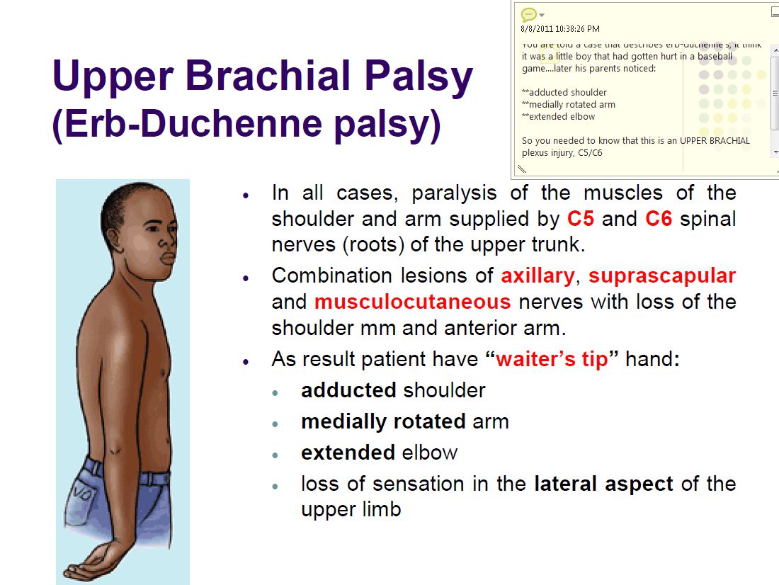 Extra - no abduction (supraspinatus/deltoid, suprascapular + axilary ...