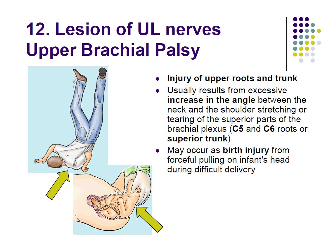 Extra - no abduction (supraspinatus/deltoid, suprascapular + axilary ...