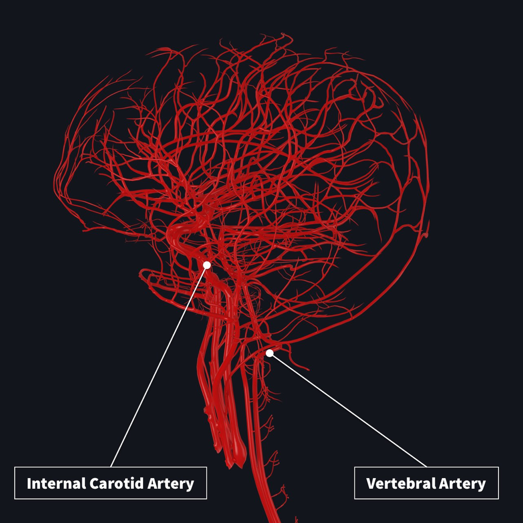 Back From the right and left internal carotid arteries (comes directly ...