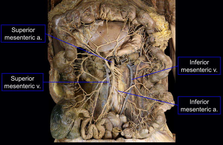 Inferior Mesenteric Vein Cadaver