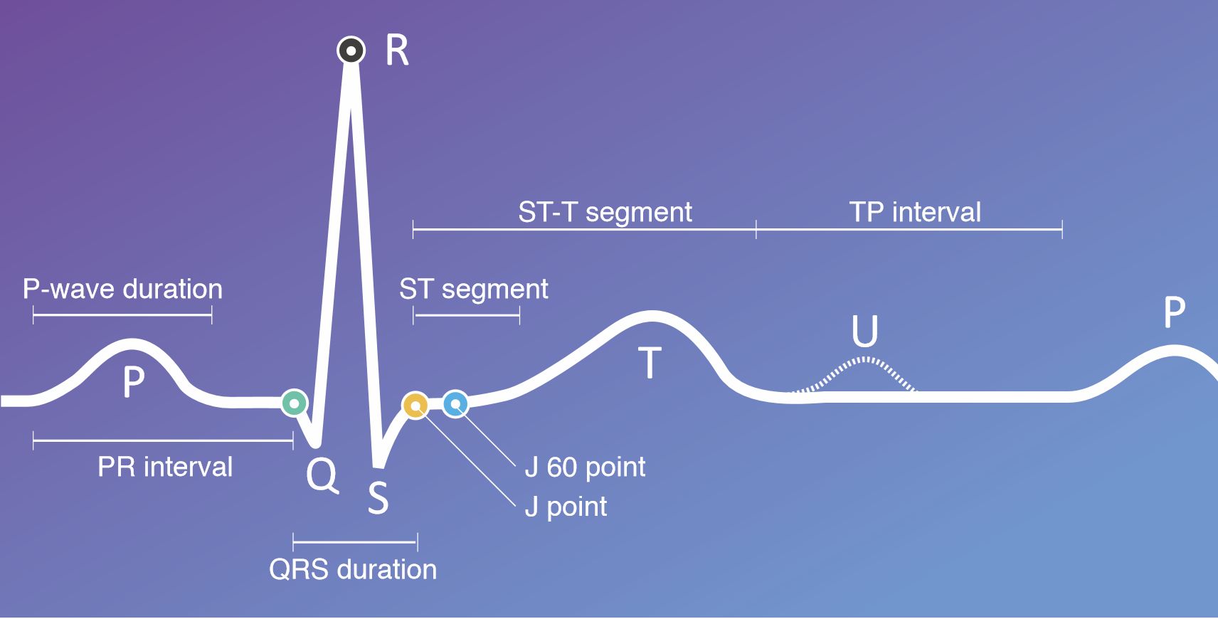 Ekg Rst Extra