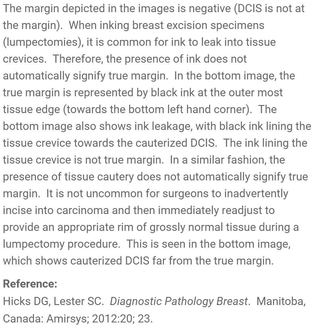 Anatomy of the Breast - AnkiWeb